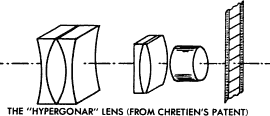 Hypergonar diagram